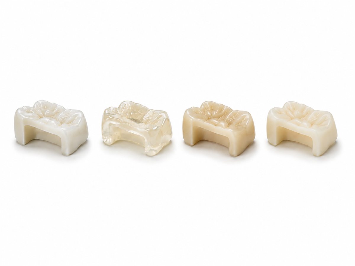 Incrustaciones en diferentes materiales
